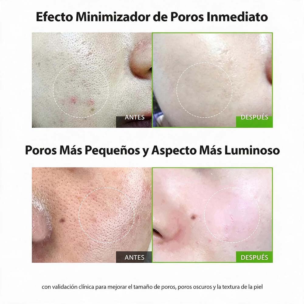 GREEN TOMATO NMN PORE LIFTING AMPOULE (AMPOLLETA PARA EL CUIDADO DE LOS POROS)